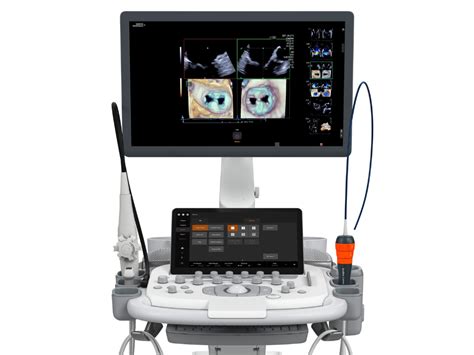 advanced ultrasound systems|ACUSON Origin Cardiovascular Ultrasound System .